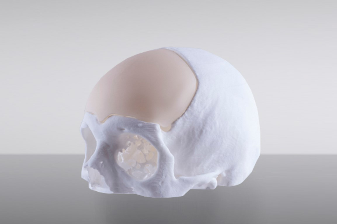 sacchelli tecnologie applicate cranio