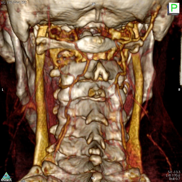 tecnologia applicata ricostruzione 3d