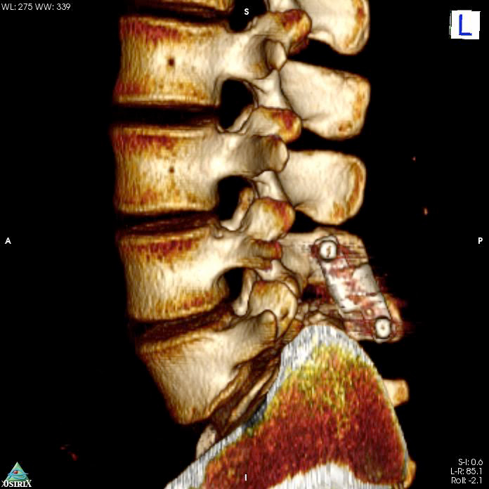tecnologie applicate ricostruzione 3d